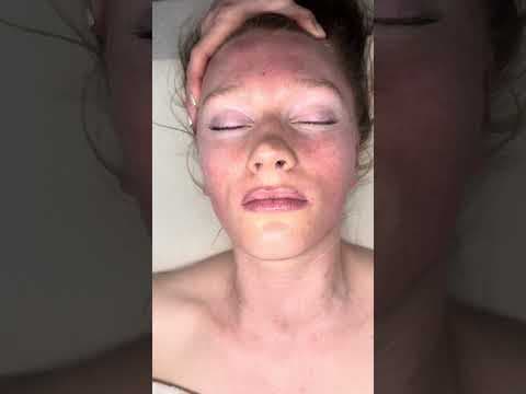 Melting away forehead tension